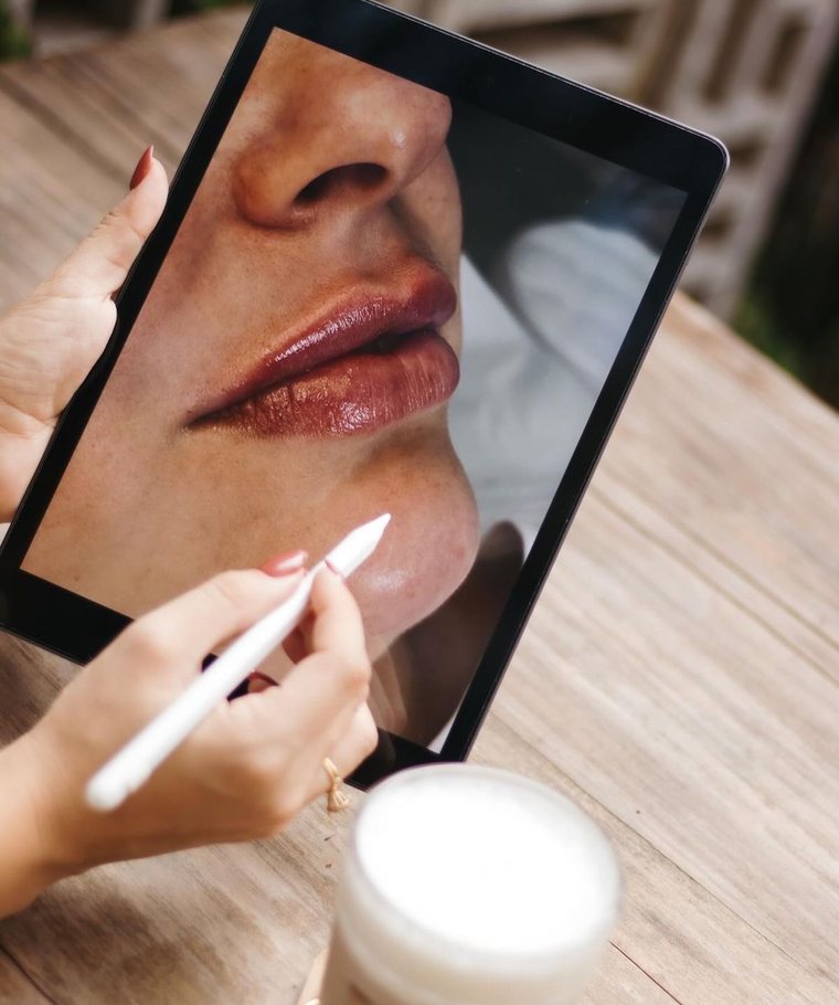 Diseño digital del perfil labial sobre tablet antes del procedimiento