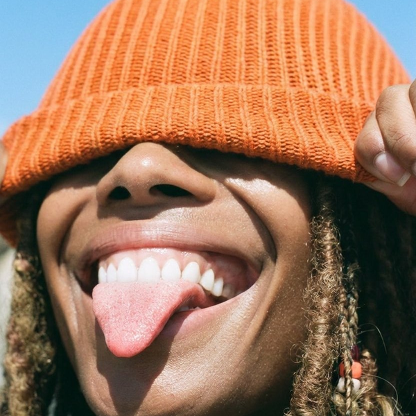 Resultado de blanqueamiento y diseño de sonrisa personalizado en Santiago Chile